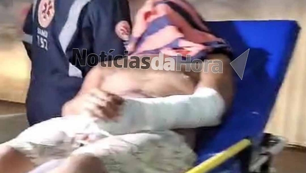 Faccionados atacam homem no Benfica por causa de som alto em sua residência