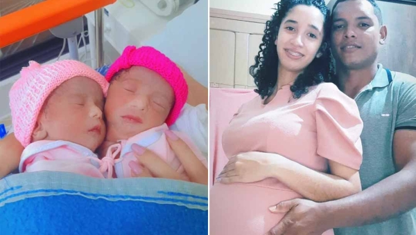 Gêmeas Siamesas Allana e Aylla morrem em Brasília; recém-nascidas dividiam mesmo coração