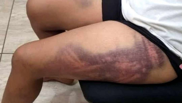 Marido ataca mulher a pauladas após ler mensagens de suposto amante