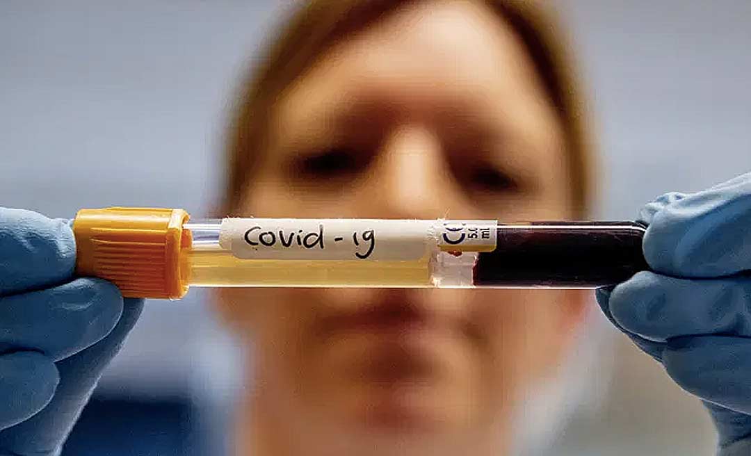 Mais uma pessoa foi curada do coronavírus no Acre e casos não aumentaram nas últimas 24 horas