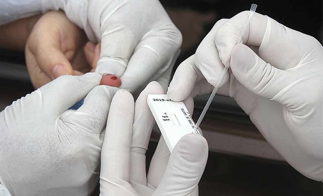 Apenas os testes rápidos de covid-19 foram divulgados nesta segunda, por isso houve só 13 casos confirmados no Acre