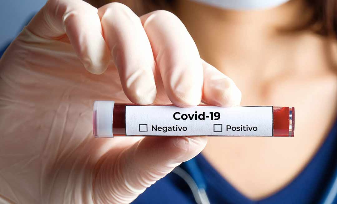 Covid-19: boletim da Sesacre não registrou morte nas últimas 24 horas