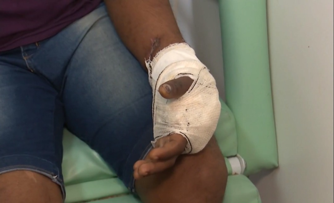 Pacientes com braços e pernas quebradas lotam corredores do Pronto-Socorro