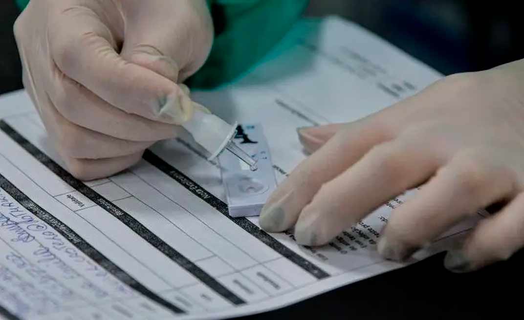 Prefeitura de Rio Branco abre cotação de preço para compra de testes rápidos para diagnóstico da covid-19