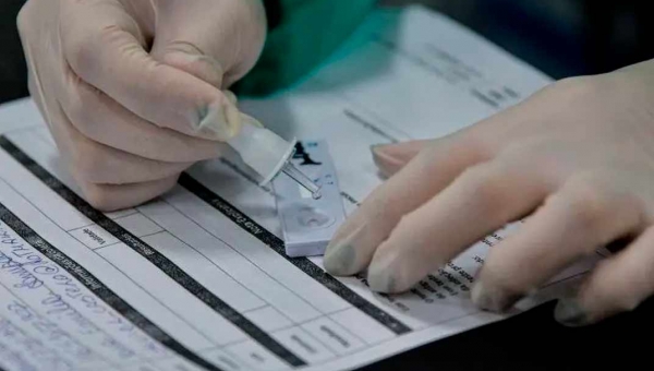 Prefeitura de Rio Branco abre cotação de preço para compra de testes rápidos para diagnóstico da covid-19