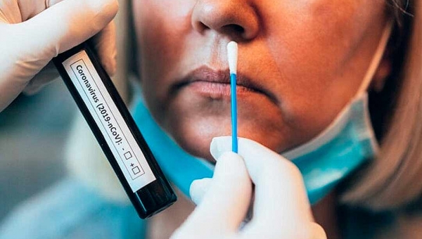 Número de casos de covid volta a subir e registra 279 novas infecções por coronavírus