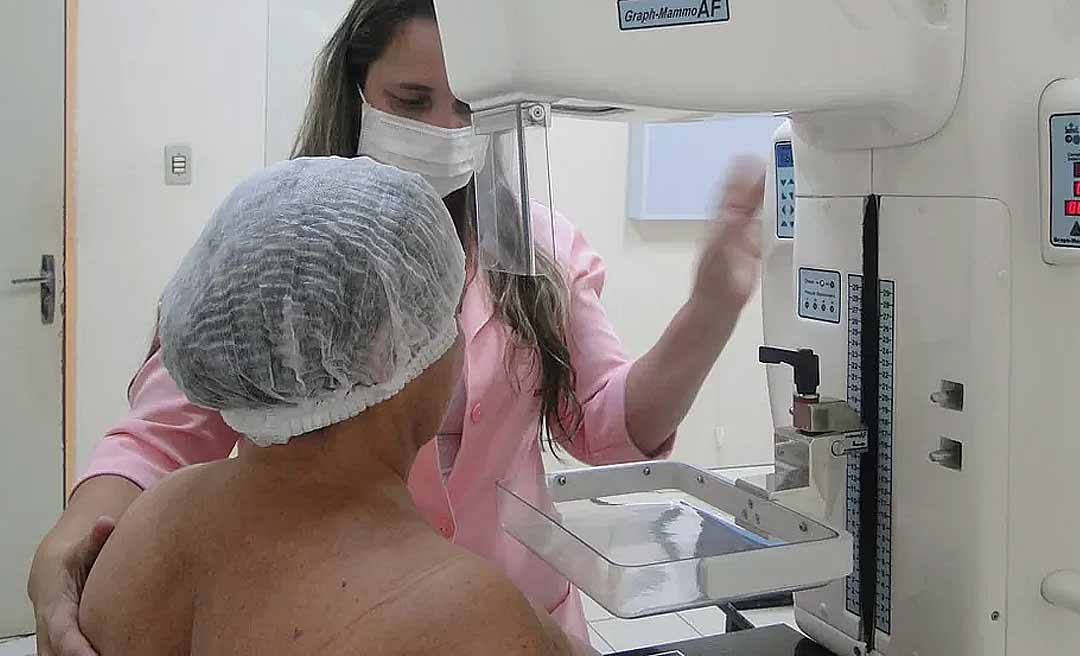 Hospital de Amor realiza 300 mamografias e PCCUs gratuitos em Rodrigues Alves