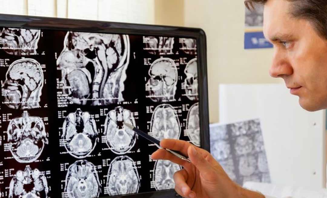 Saúde do Estado realiza mutirão de exames para diagnóstico de doenças neurológicas em crianças