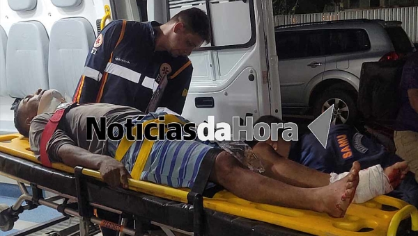 Motoboy faz manobra radical em via pública, cai e dilacera o pé esquerdo