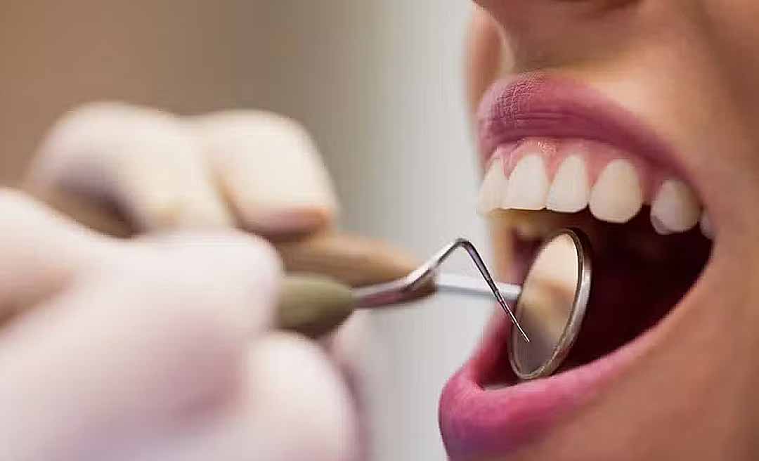 Reforma Tributária: veja profissionais que terão desconto de até 60% no imposto