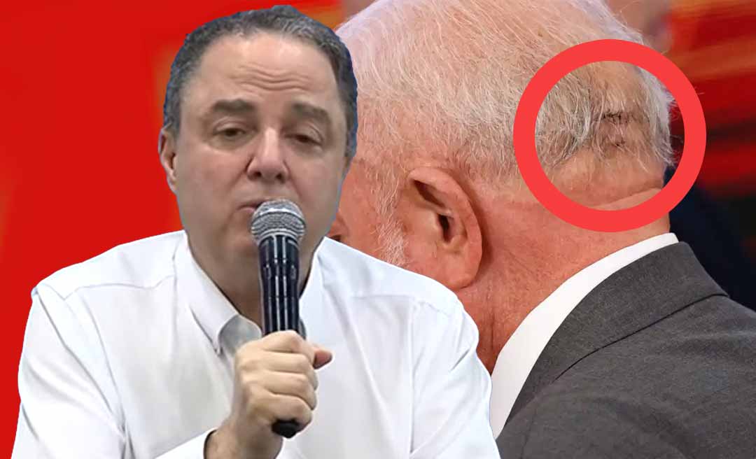 Médico de Lula descarta sequela e diz que função cerebral está intacta