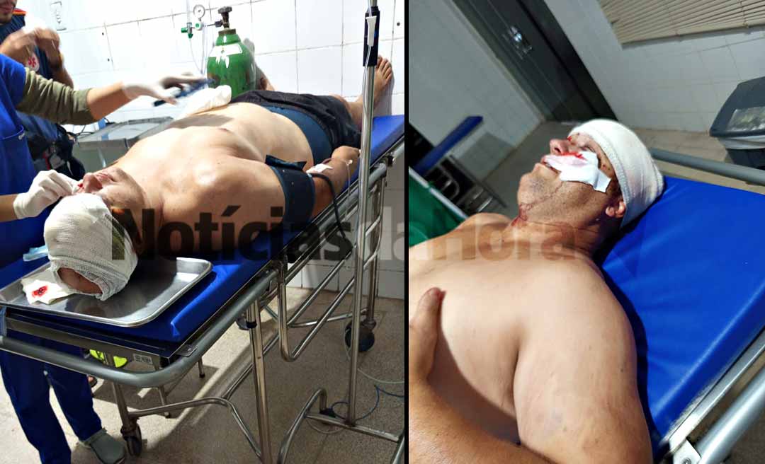 Tentativa de homicídio no interior: Homem é baleado no rosto na zona rural de Manoel Urbano