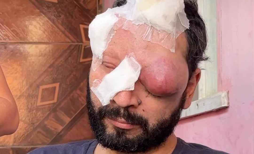 Fé, luta e esperança: homem que saiu de Porto Alegre para casar com acreana descobre câncer agressivo e pede ajuda