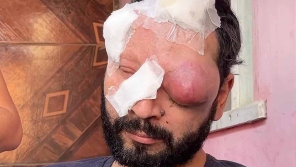 Fé, luta e esperança: homem que saiu de Porto Alegre para casar com acreana descobre câncer agressivo e pede ajuda