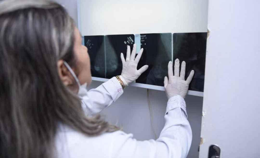 Acre registra 391 novos casos de câncer de mama em três anos, mostra levantamento