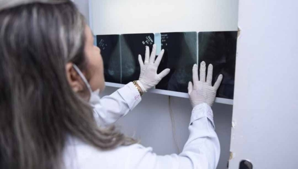 Acre registra 391 novos casos de câncer de mama em três anos, mostra levantamento