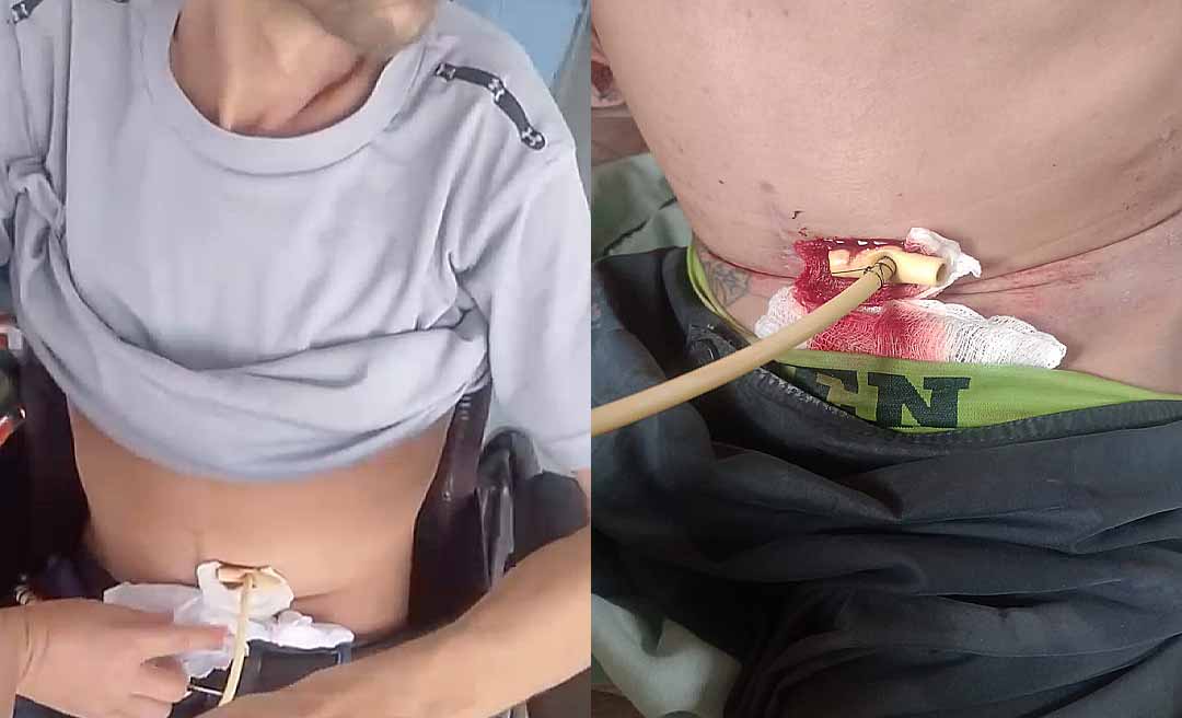 Paciente oncológico morre após denúncias de negligência e abandono no UNACON