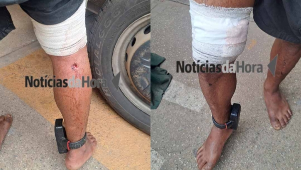 Homem monitorado pela Justiça é baleado em “ato de disciplina” e pede ajuda ao SAMU em Rio Branco