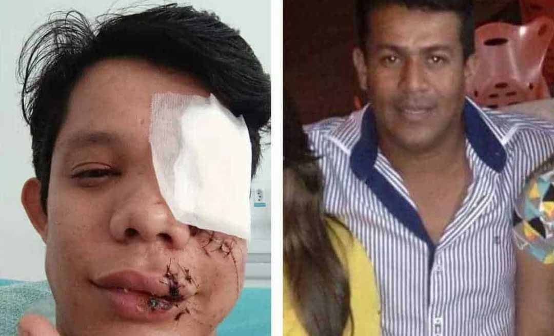 Homem que agrediu professor em Brasiléia em 2023, o empresário “Super Negão”, morre em academia