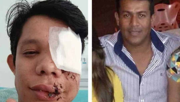 Homem que agrediu professor em Brasiléia em 2023, o empresário “Super Negão”, morre em academia