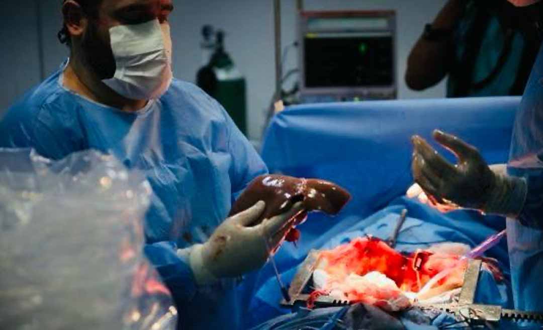 Mais de 70 acreanos aguardam na fila por transplante de rim ou fígado, aponta Ministério da Saúde