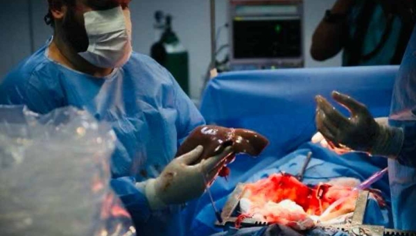 Mais de 70 acreanos aguardam na fila por transplante de rim ou fígado, aponta Ministério da Saúde