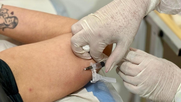 Prefeitura de Rio Branco amplia acesso ao Implanon e capacita profissionais na URAP Roney Meireles