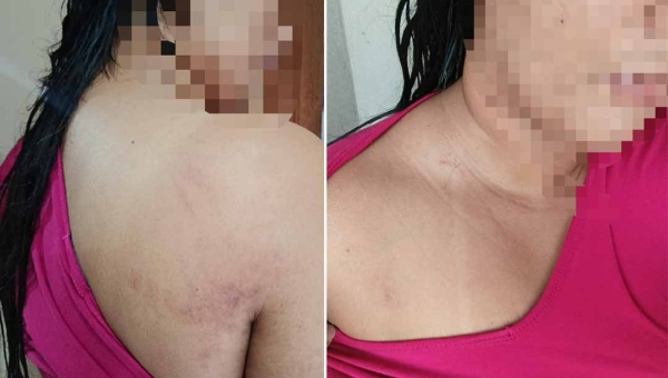 Familiar de paciente internado no Pronto-Socorro da Capital acusa policiais de ação truculenta; denúncias foram formalizadas junto à Corregedoria da PM e ao MPAC