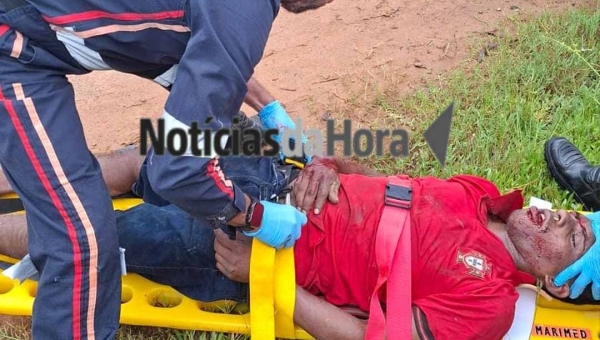 Motociclista perde controle ao tentar desviar de buraco e sofre colisão frontal com caminhonete em Rio Branco