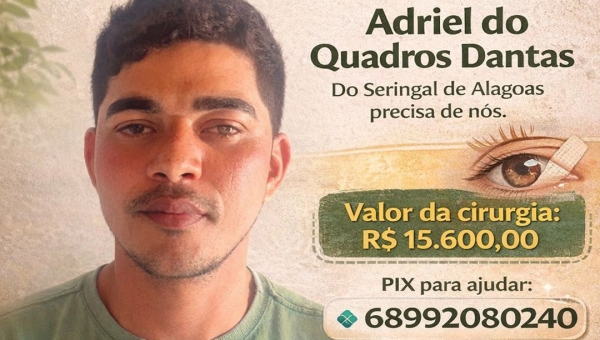 Vaquinha solidária mobiliza apoio para cirurgia urgente de jovem acreano que corre risco de perder a visão