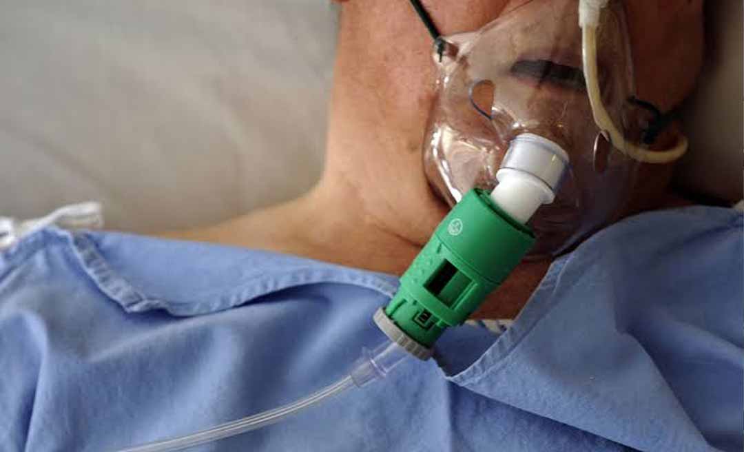 Acre registra avanço de casos de SRAG e acompanha cenário de alerta em quase todo o país
