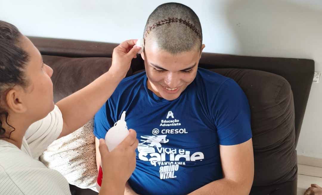Após retirada de tumor no cérebro, jovem acreano precisa de ajuda para seguir tratamento em Manaus